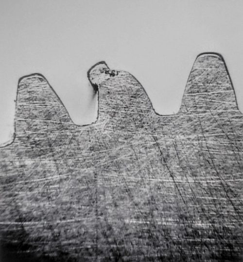 tooth deformation 1